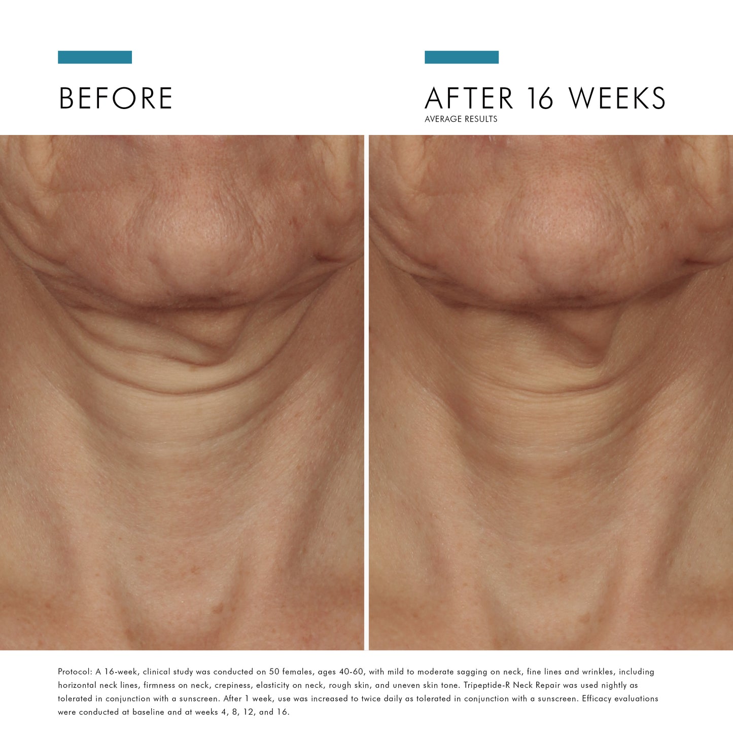 SkinCeuticals Tripeptide-R Neck Repair
