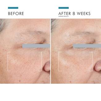 SkinCeuticals A.G.E. Advanced Eye
