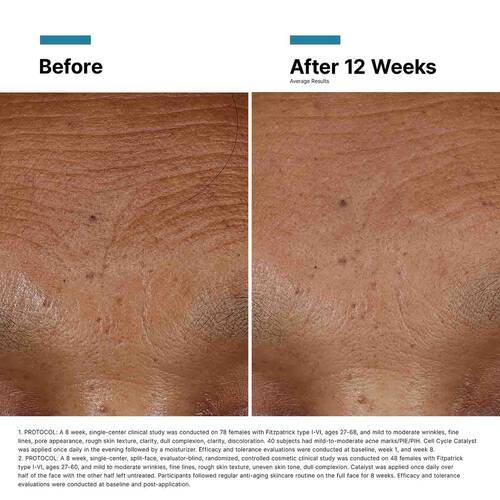 SkinCeuticals HAI Multi-Glycan