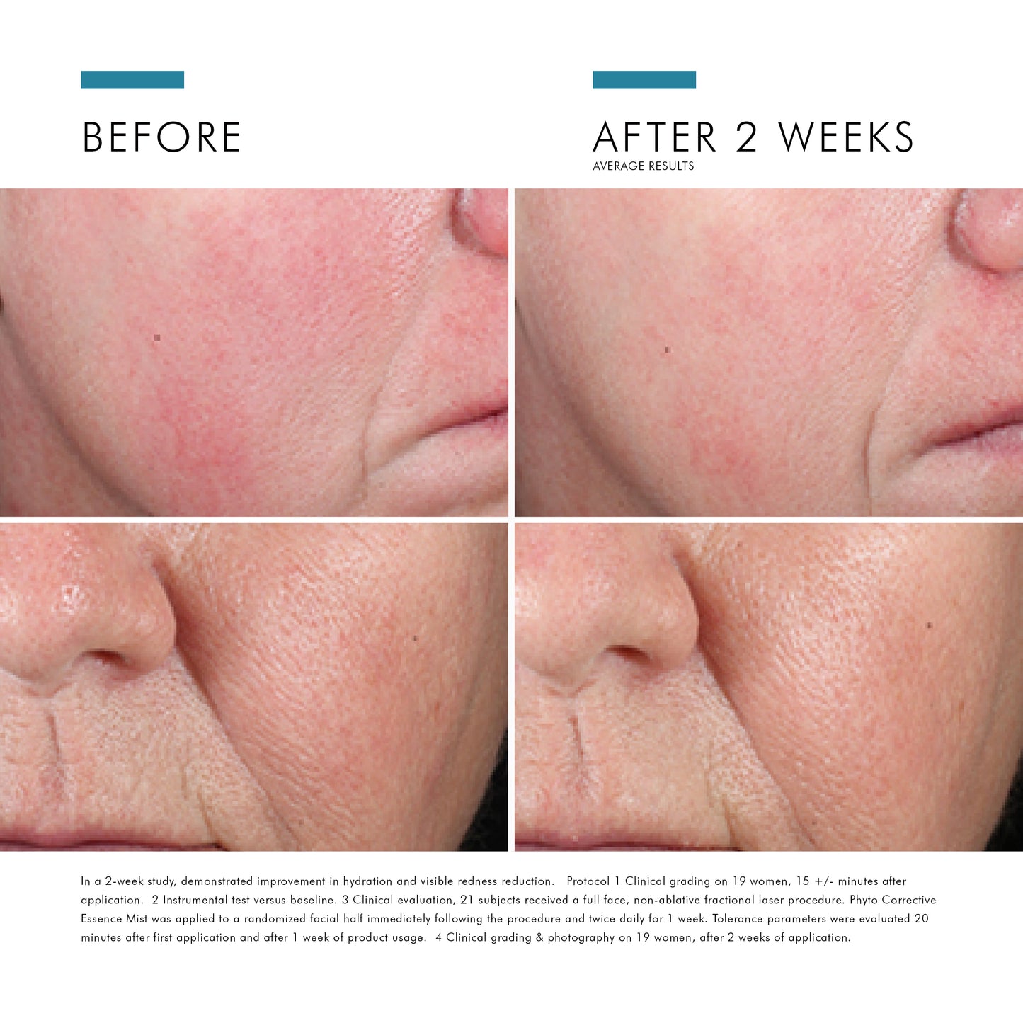 SkinCeuticals Phyto Corrective Essence Mist