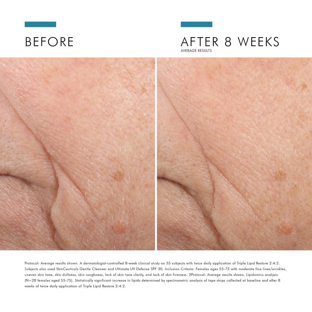 Skinceuticals Triple Lipid Restore 2:4:2